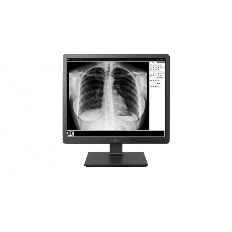 Monitor LG Clinical - 19" HD SXGA IPS / 5ms / VGA DVI HDMI DP USB / VESA / Tilt / Pivot