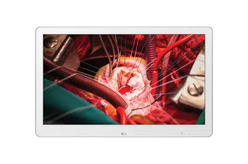 Monitor Cirúrgico LG - 27" Full HD IPS / VGA DVI HDMI / 3G-SDI USB IP35/IP32 - 27HK510S-W