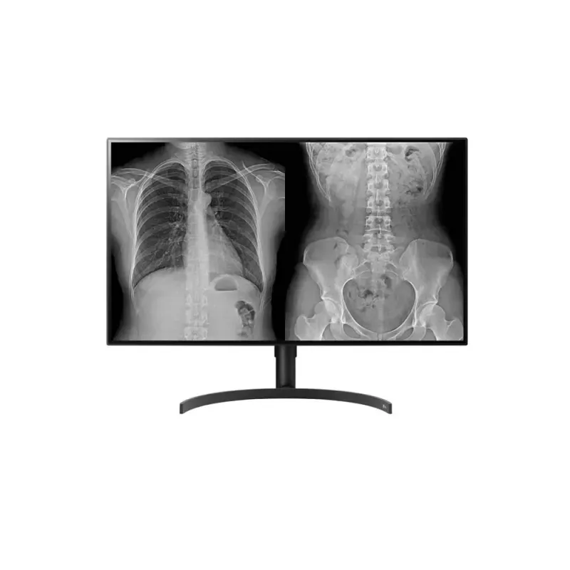 LG MONITOR DIAGNOSTICO IPS 32" (31.5) 8MP UHD 4K HDMI DP HAS PIVOT 32HL512D